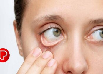 ഹീമോഗ്ലോബിന്‍റെ അളവ് കൂട്ടാൻ കഴിക്കേണ്ട ഭക്ഷണങ്ങൾ