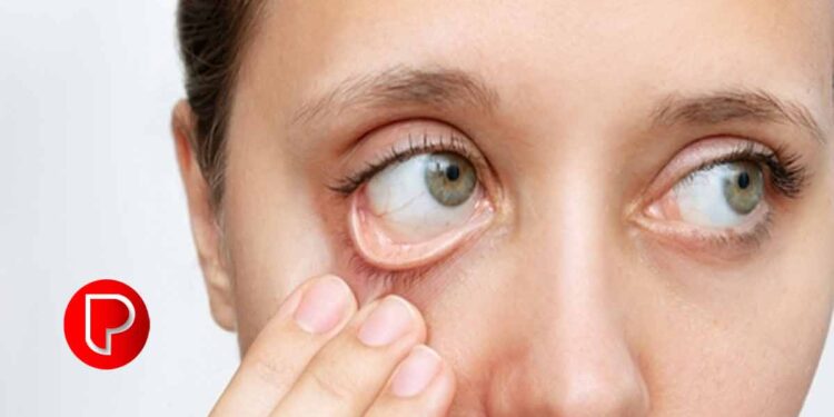 ഹീമോഗ്ലോബിന്‍റെ അളവ് കൂട്ടാൻ കഴിക്കേണ്ട ഭക്ഷണങ്ങൾ