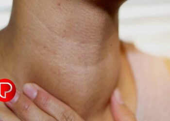 തൈറോയ്ഡിനുണ്ടാകുന്ന ക്യാൻസർ എങ്ങനെ തിരിച്ചറിയാം