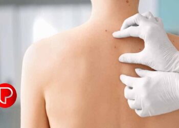 തൊലിപ്പുറത്ത് കാണപ്പെടുന്ന നിറവ്യത്യാസവും പാടുകളും ശ്രദ്ധിക്കാതെ പോകരുത്