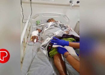 തോട്ടുമുക്കത്ത് പട്ടാപ്പകല്‍ കാട്ടുപന്നി ആക്രമണം; റിട്ട. അധ്യാപികക്ക് ഗുരുതര പരിക്ക്