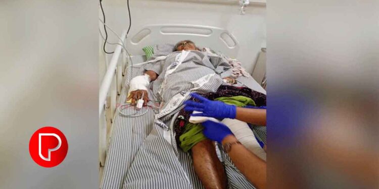 തോട്ടുമുക്കത്ത് പട്ടാപ്പകല്‍ കാട്ടുപന്നി ആക്രമണം; റിട്ട. അധ്യാപികക്ക് ഗുരുതര പരിക്ക്