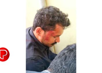 മലയോര മേഖലയില്‍ വീണ്ടും കാട്ടുപന്നി ആക്രമണം; മുക്കം പൊറ്റശേരി സ്വദേശിയായ യുവാവിന് പരിക്ക്