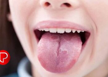 വിറ്റാമിന്‍ ബി12 കുറഞ്ഞാല്‍ ശരീരത്തിന് സംഭവിക്കുന്നത്