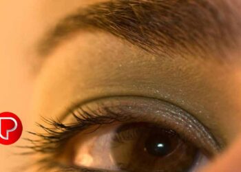 മഞ്ഞപ്പിത്തം പടരുന്നു ; രോഗം സ്ഥിരീകരിച്ചത് 51 പേർക്ക്