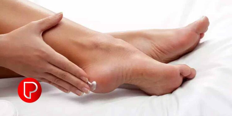 പാദങ്ങള്‍ വിണ്ടു കീറുന്നത് തടയാൻ ചെയ്യേണ്ടത്