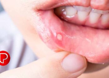 വിറ്റാമിൻ ബി 12ന്‍റെ കുറവുമൂലം ഉണ്ടാവുന്ന അസുഖം അറിയാം