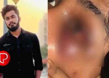 ഇൻസ്റ്റാഗ്രാം വഴി അശ്ലീല സന്ദേശം; ചോദ്യം ചെയ്ത യുവതിക്ക് ക്രൂരമർദ്ദനം; പ്രതി ഒളിവിലാണെന്ന് പോലീസ്