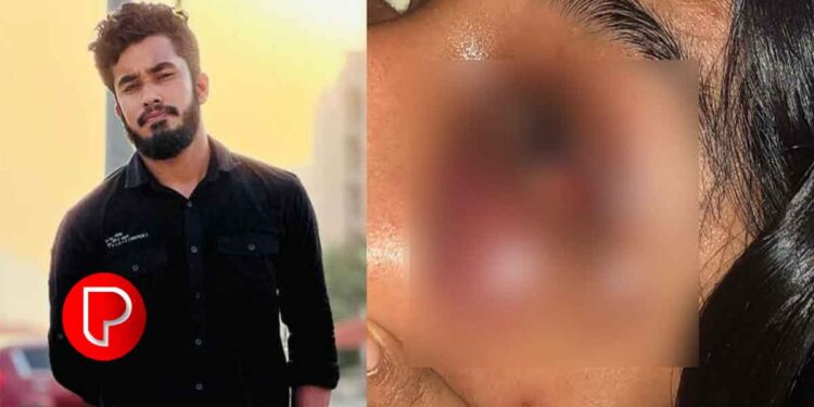 ഇൻസ്റ്റാഗ്രാം വഴി അശ്ലീല സന്ദേശം; ചോദ്യം ചെയ്ത യുവതിക്ക് ക്രൂരമർദ്ദനം; പ്രതി ഒളിവിലാണെന്ന് പോലീസ്