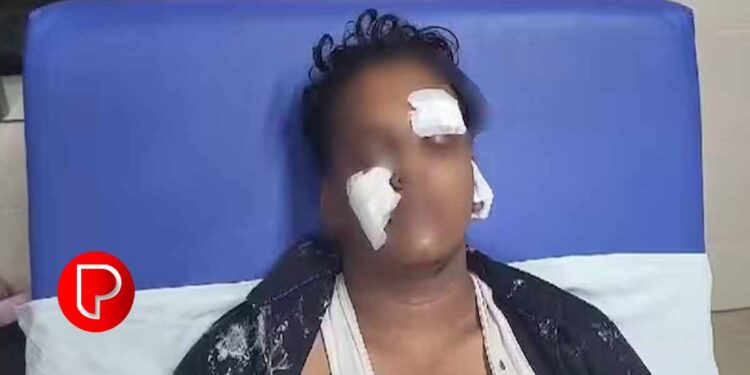 വയനാട്ടിലെ സ്കൂളിൽ പതിനഞ്ചുകാരന് സഹപാഠികളുടെ ക്രൂരമര്‍ദ്ദനം ; മുഖത്ത് രണ്ട് ഭാഗങ്ങളിലും നെഞ്ചിലും കുത്തി