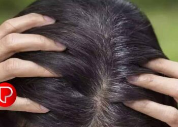 ചെറുപ്രായത്തിൽ തലമുടി നരക്കുന്നത് ഈ ഭക്ഷണങ്ങളുടെ കുറവ്