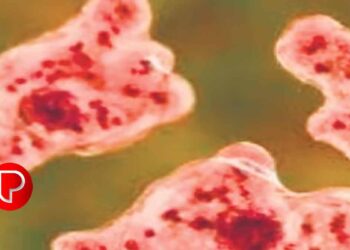 വീണ്ടും അമീബിക് മസ്തിഷ്‌കജ്വരം ; കോഴിക്കോട് 12 കാരന്റെ നില ഗുരുതരം