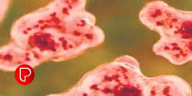 വീണ്ടും അമീബിക് മസ്തിഷ്‌കജ്വരം ; കോഴിക്കോട് 12 കാരന്റെ നില ഗുരുതരം