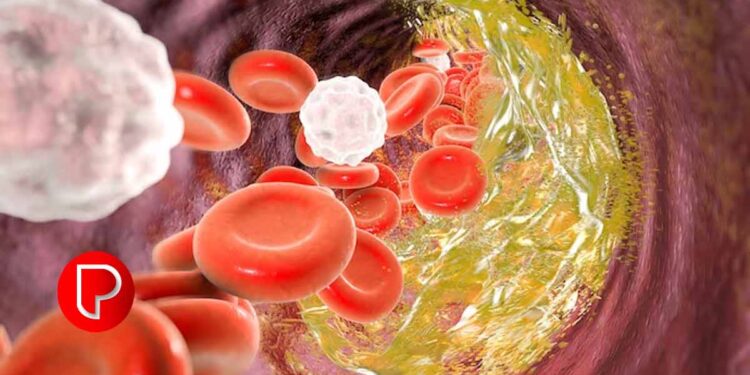 കൊളസ്ട്രോൾ കുറയ്ക്കാൻ കഴിക്കേണ്ടത്