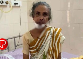 കോഴിക്കോട് വയോധികയെ ആക്രമിച്ച്‌ മാല കവര്‍ന്ന സംഭവം; സിസിടിവി കേന്ദ്രീകരിച്ച് അന്വേഷണം