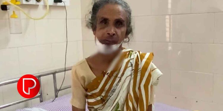 കോഴിക്കോട് വയോധികയെ ആക്രമിച്ച്‌ മാല കവര്‍ന്ന സംഭവം; സിസിടിവി കേന്ദ്രീകരിച്ച് അന്വേഷണം