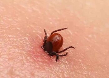 കോഴിക്കോട് ചികിത്സയിലുള്ള കുട്ടിക്ക് ചെള്ളുപനി സ്ഥിരീകരിച്ചു; നിപ ഫലം വൈകീട്ട്