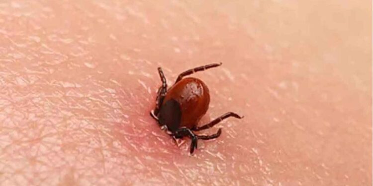 കോഴിക്കോട് ചികിത്സയിലുള്ള കുട്ടിക്ക് ചെള്ളുപനി സ്ഥിരീകരിച്ചു; നിപ ഫലം വൈകീട്ട്