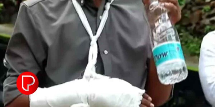 കൊടുവള്ളി സ്കൂളില്‍ ക്രൂര റാഗിങ്: രണ്ട് പ്ലസ് ടു വിദ്യാര്‍ഥികളെ സസ്പെൻഡ് ചെയ്തു