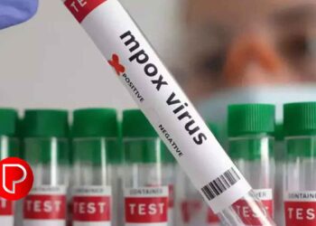 മലപ്പുറത്ത് എംപോക്‌സ് സ്ഥിരീകരിച്ചു