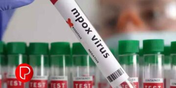 മലപ്പുറത്ത് എംപോക്‌സ് സ്ഥിരീകരിച്ചു