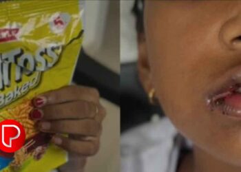 ചെറുവാടിയിൽ ഫുൾടോസ്സ് പായ്ക്കറ്റ് പലഹാരം കഴിച്ച ബാലികയുടെ നാവില്‍ പൊള്ളലേറ്റു