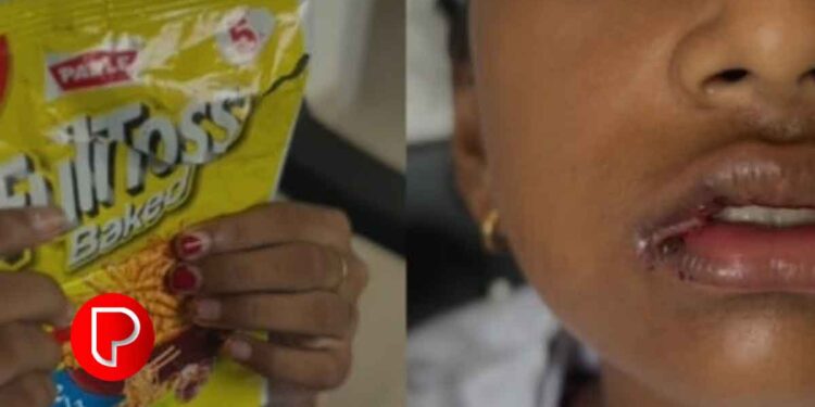 ചെറുവാടിയിൽ ഫുൾടോസ്സ് പായ്ക്കറ്റ് പലഹാരം കഴിച്ച ബാലികയുടെ നാവില്‍ പൊള്ളലേറ്റു