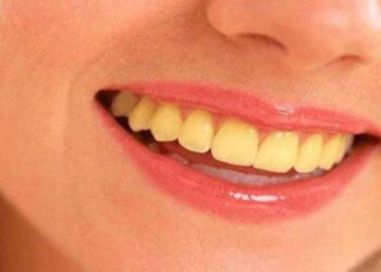 പല്ലുകളിലെ മഞ്ഞ നിറം മാറ്റാന്‍ വീട്ടില്‍ പരീക്ഷിക്കേണ്ടത്