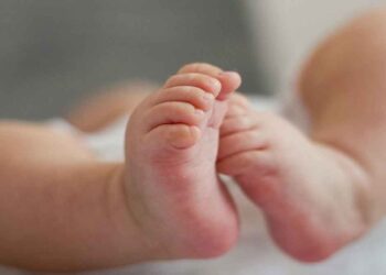 ആലപ്പുഴയിലെ നവജാത ശിശുവിൻറെ വൈകല്യം; നാല് ഡോക്ടർമാർക്കെതിരെ കേസെടുത്ത് പൊലീസ്