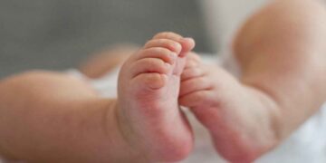 ആലപ്പുഴയിലെ നവജാത ശിശുവിൻറെ വൈകല്യം; നാല് ഡോക്ടർമാർക്കെതിരെ കേസെടുത്ത് പൊലീസ്