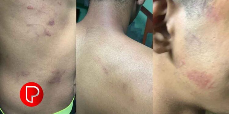 നടുവണ്ണൂരില്‍ സമൂഹമാധ്യമങ്ങളില്‍ പോസ്റ്റ് ഇടുന്നതിനെ ചൊല്ലി തര്‍ക്കം; പ്ലസ് വണ്‍ വിദ്യാര്‍ഥിക്ക് സീനിയേഴ്സിൻ്റെ മര്‍ദനം