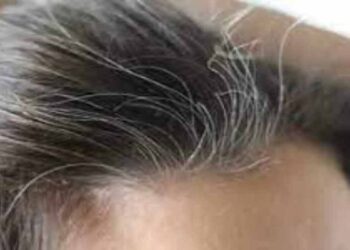 അകാലനര അകറ്റാന്‍ വീട്ടില്‍ ചെയ്യേണ്ടത്