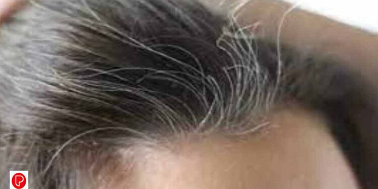 അകാലനര അകറ്റാന്‍ വീട്ടില്‍ ചെയ്യേണ്ടത്