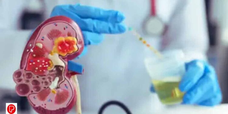 വൃക്കരോഗത്തിന്റെ ലക്ഷണങ്ങൾ അറിയാതെ പോകരുതേ