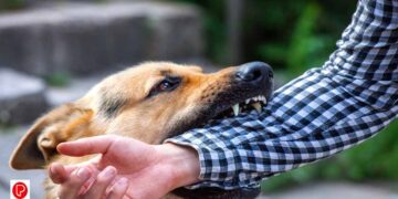 മൃഗങ്ങളുടെ കടിയേറ്റാൽ സ്വകാര്യ ആശുപത്രികളിൽ സൗജന്യ അടിയന്തര ചികിത്സ