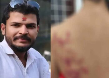 മരടില്‍ യുവതിക്ക് ലിവ് ഇന്‍ പങ്കാളിയുടെ ക്രൂരമര്‍ദനം; പ്രതി യുവമോര്‍ച്ച എറണാകുളം ജില്ലാ ജനറല്‍ സെക്രട്ടറി