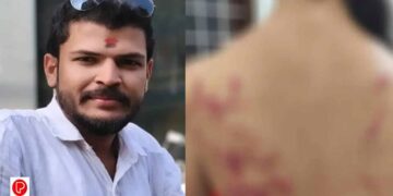 മരടില്‍ യുവതിക്ക് ലിവ് ഇന്‍ പങ്കാളിയുടെ ക്രൂരമര്‍ദനം; പ്രതി യുവമോര്‍ച്ച എറണാകുളം ജില്ലാ ജനറല്‍ സെക്രട്ടറി