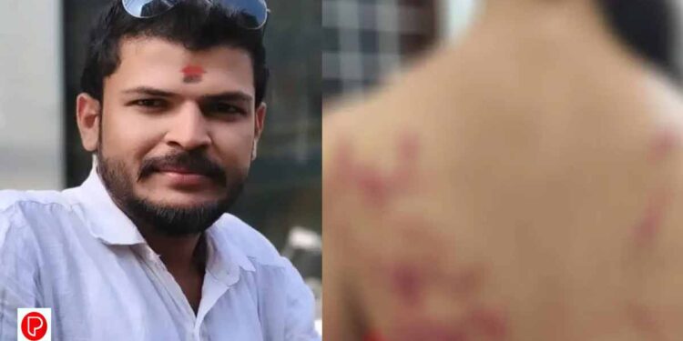 മരടില്‍ യുവതിക്ക് ലിവ് ഇന്‍ പങ്കാളിയുടെ ക്രൂരമര്‍ദനം; പ്രതി യുവമോര്‍ച്ച എറണാകുളം ജില്ലാ ജനറല്‍ സെക്രട്ടറി