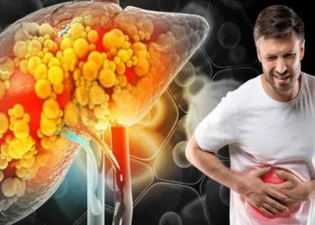 കൊഴുപ്പ് കുറയ്ക്കാം, ഫാറ്റി ലിവറിനെ പിടിച്ചുകെട്ടാം അറിഞ്ഞിരിക്കേണ്ടത്