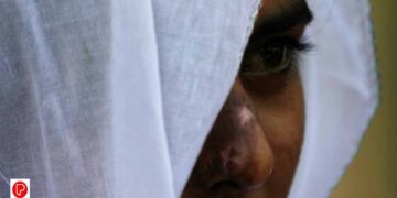 വയനാട്ടിൽ പതിനാലുകാരിക്ക് നേരെ വയോധികന്റെ ക്രൂരത ; ആസിഡ് ആക്രമണത്തിൽ പെൺകുട്ടിക്ക് ഗുരുതര പരുക്ക്