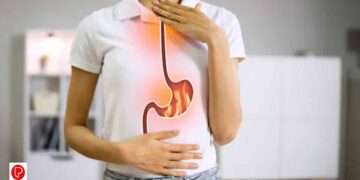 അസിഡിറ്റി പ്രശ്‌നങ്ങള്‍ അലട്ടുന്നുണ്ടോ? ഡയറ്റില്‍ ഉള്‍പ്പെടുത്തേണ്ട കാര്യങ്ങള്‍